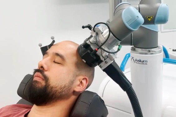 personalised-transcranial-magnetic-stimulation